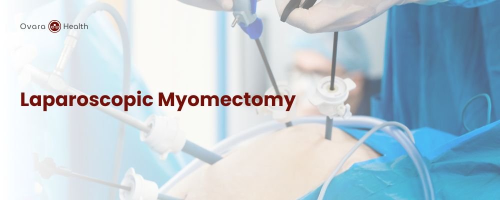 Ovara Health - Treatments - Laparoscopic Myomectomy