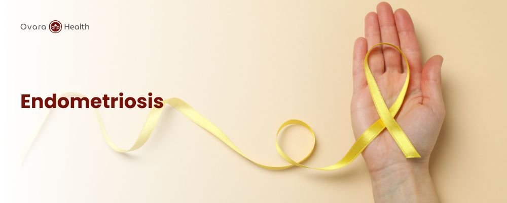 Ovara Health - Services - Endometriosis