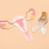 Endometriosis Treatment at Ovara Health, London