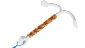 Pain After Coil Fitting