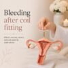 Bleeding After Coil Fitting: What Is Normal and When to Get Checked