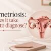 Why Does It Take So Long to Diagnose Endometriosis?